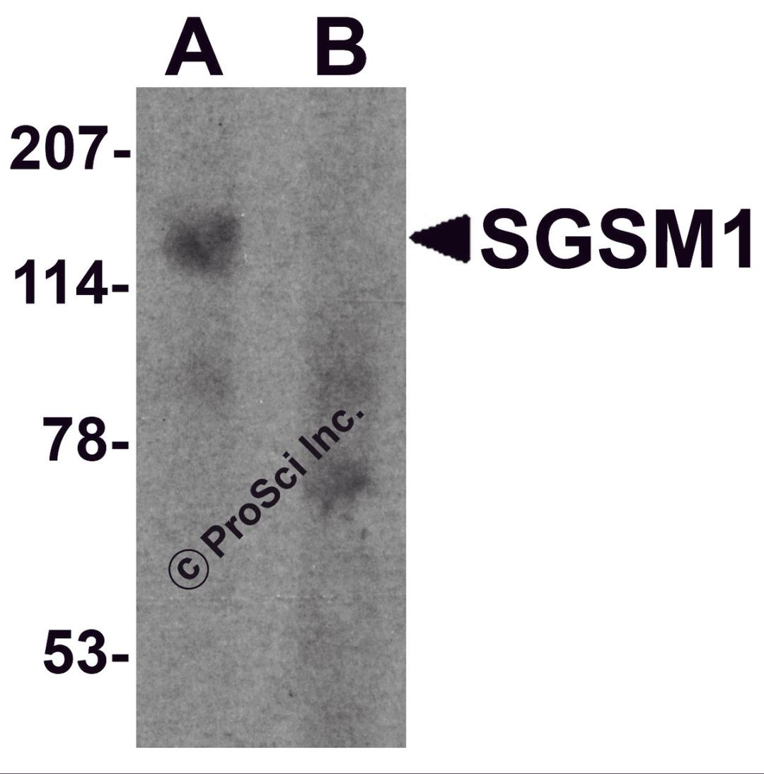 Western blot analysis of SGSM1 in human cerebellum tissue lysate with SGSM1 antibody at 1 μg/ml in (A) the absence and (B) the presence of blocking peptide.