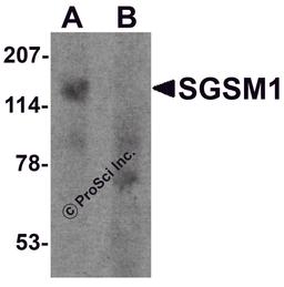 Western blot analysis of SGSM1 in human cerebellum tissue lysate with SGSM1 antibody at 1 μg/ml in (A) the absence and (B) the presence of blocking peptide.