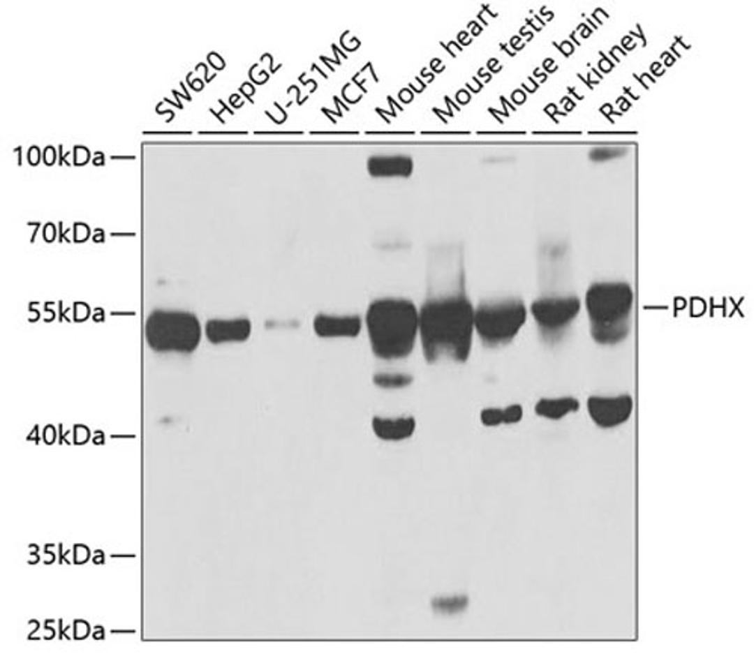 Western blot - PDHX antibody (A6426)