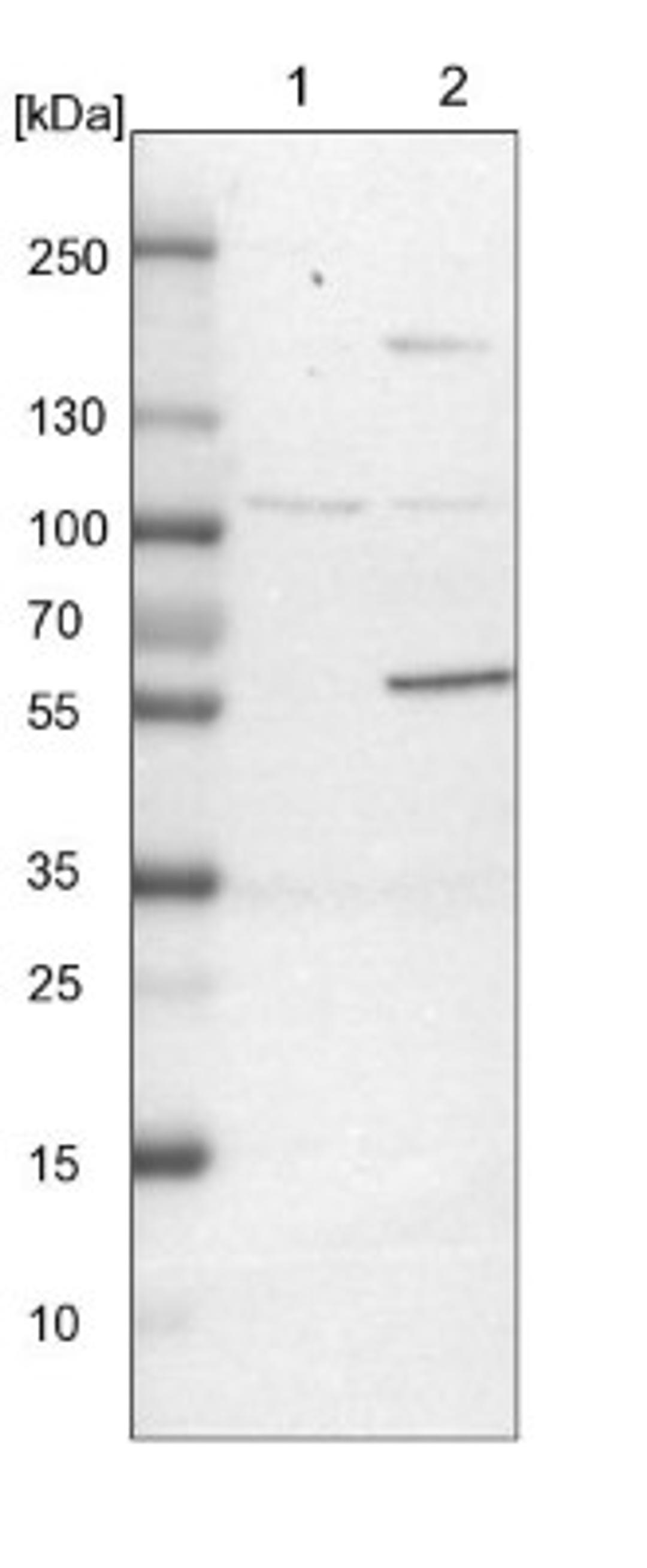 Western Blot: NUDCD1 Antibody [NBP1-85539] - Lane 1: NIH-3T3 cell lysate (Mouse embryonic fibroblast cells)<br/>Lane 2: NBT-II cell lysate (Rat Wistar bladder tumour cells)