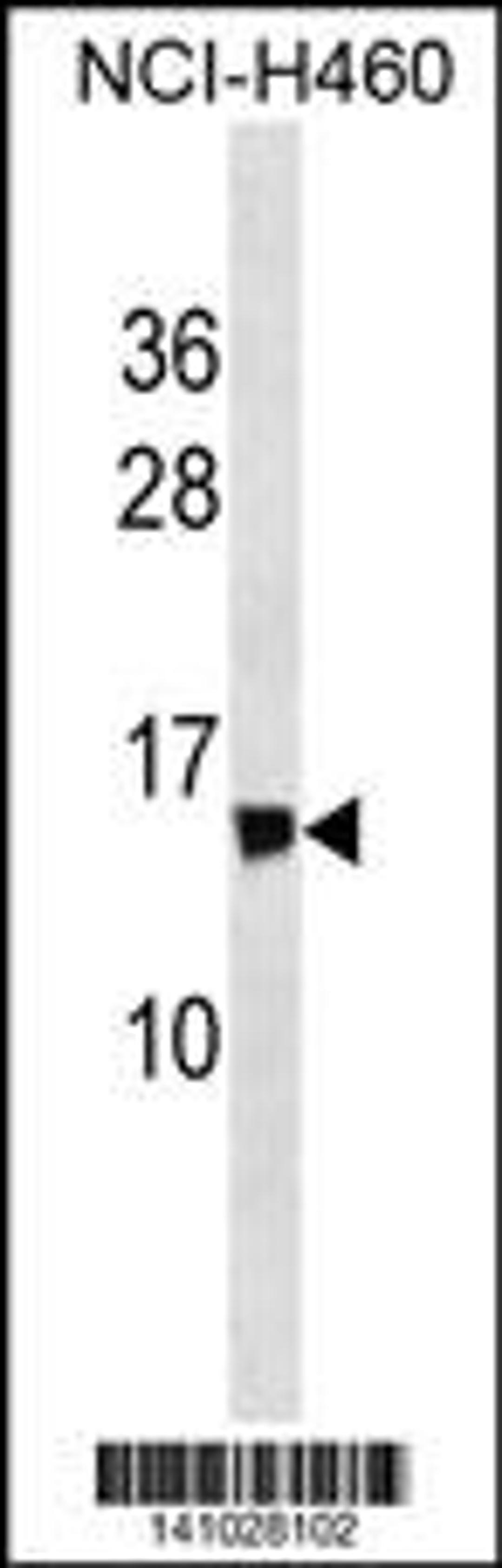 Western blot analysis in NCI-H460 cell line lysates (35ug/lane).