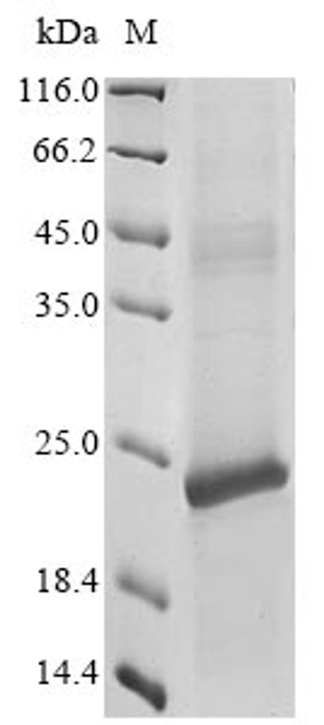 (Tris-Glycine gel) Discontinuous SDS-PAGE (reduced) with 5% enrichment gel and 15% separation gel.