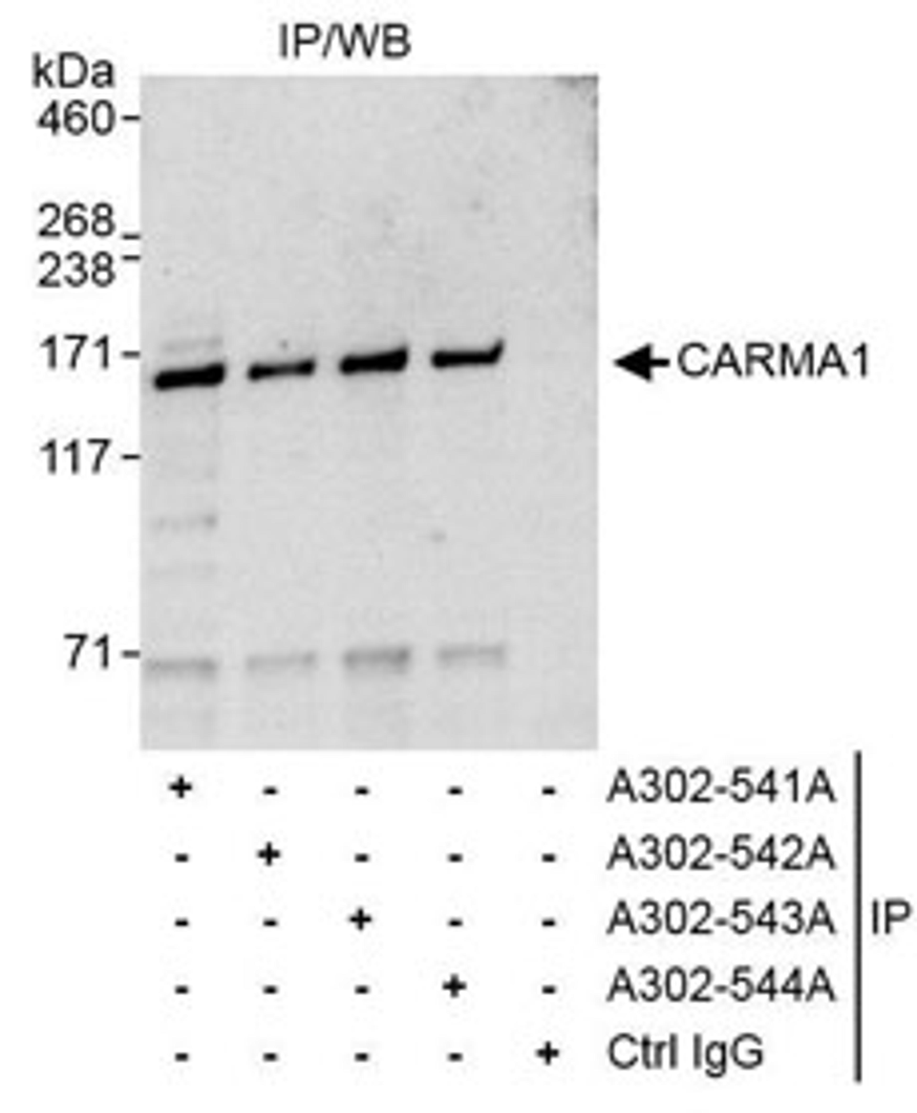 Detection of human CARMA1 by western blot of immunoprecipitates.