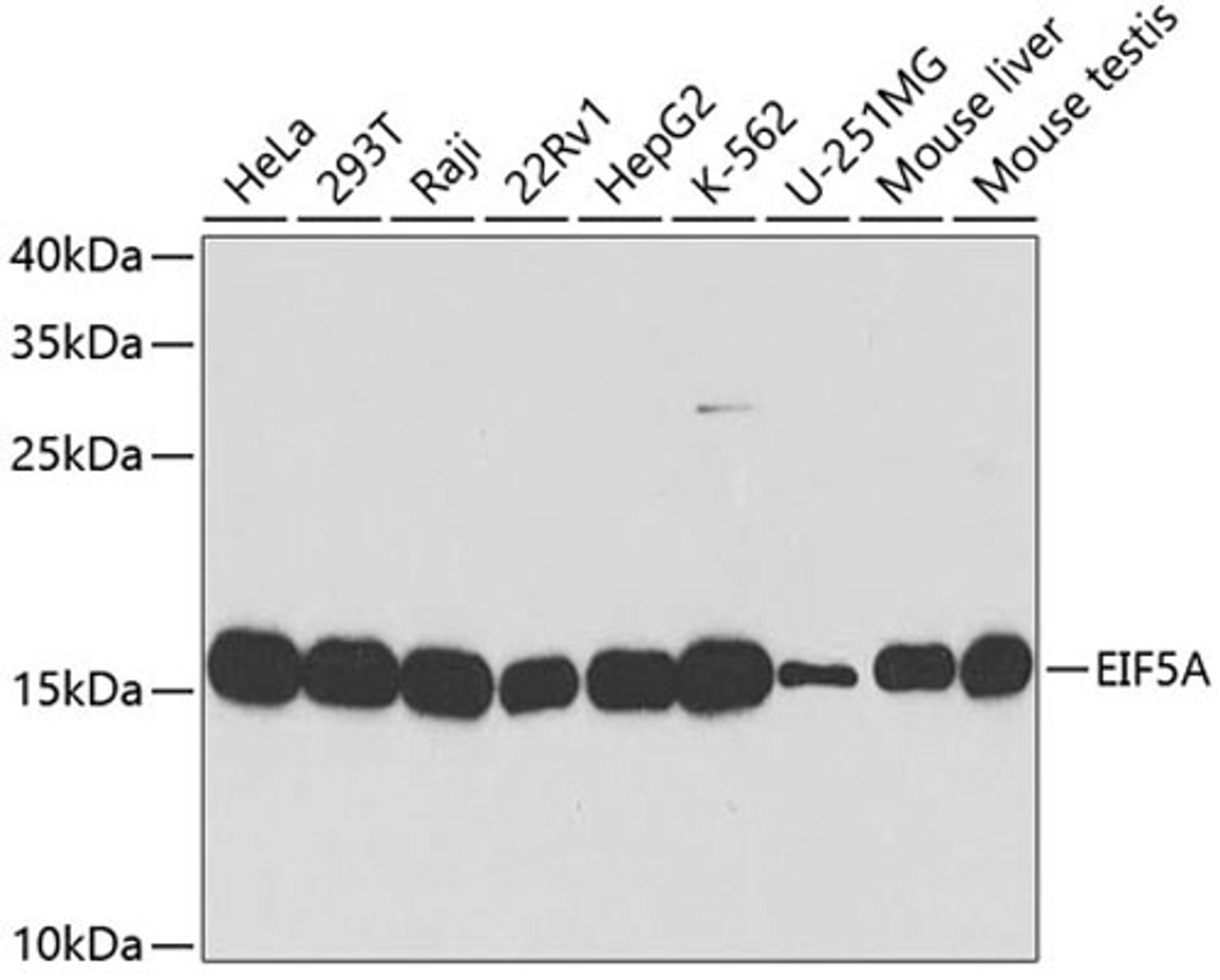 Western blot - EIF5A antibody (A2016)