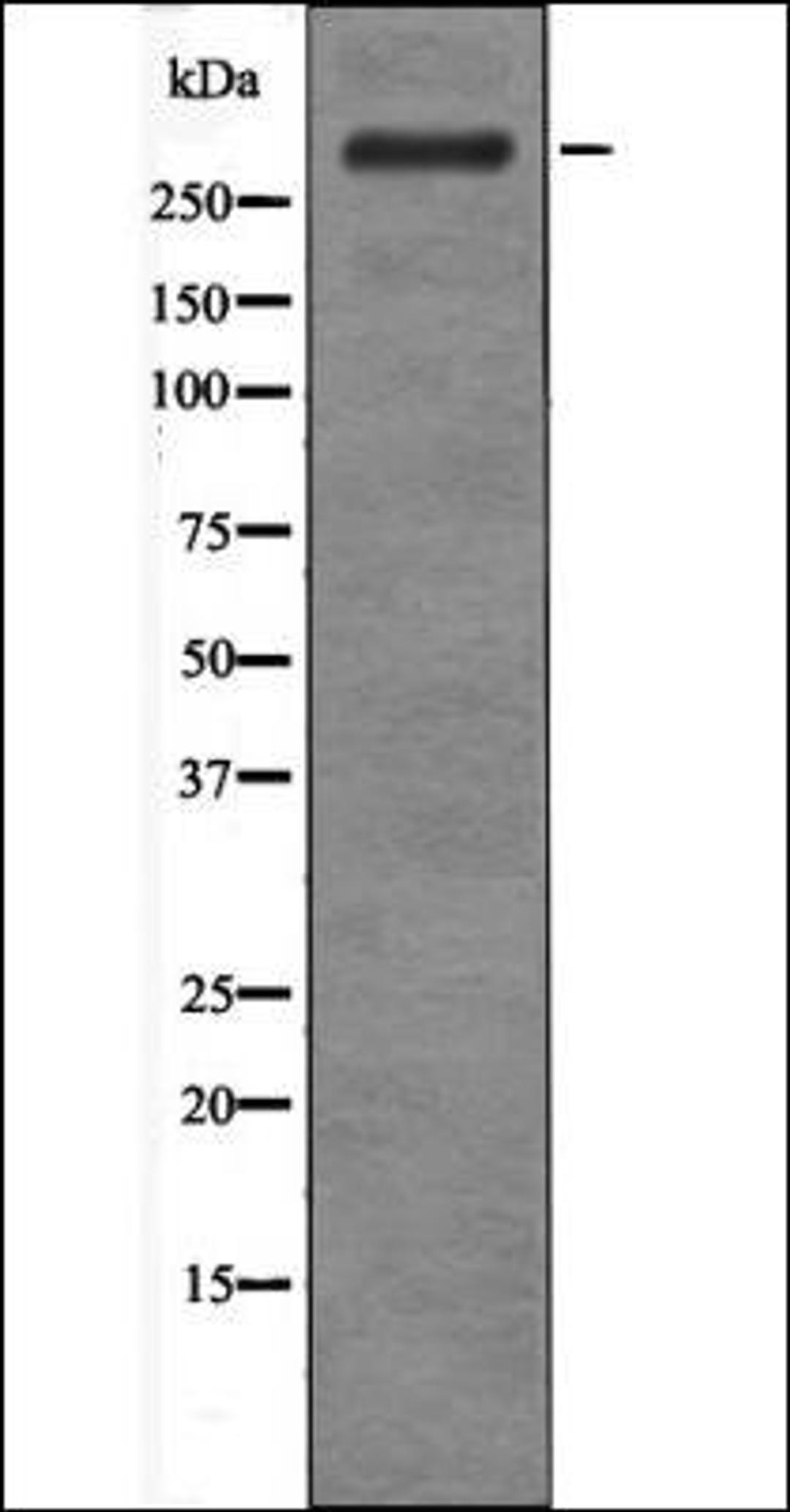 Western blot analysis of EGF treated HepG2 whole cell lysates using ATM -Phospho-Ser183- antibody