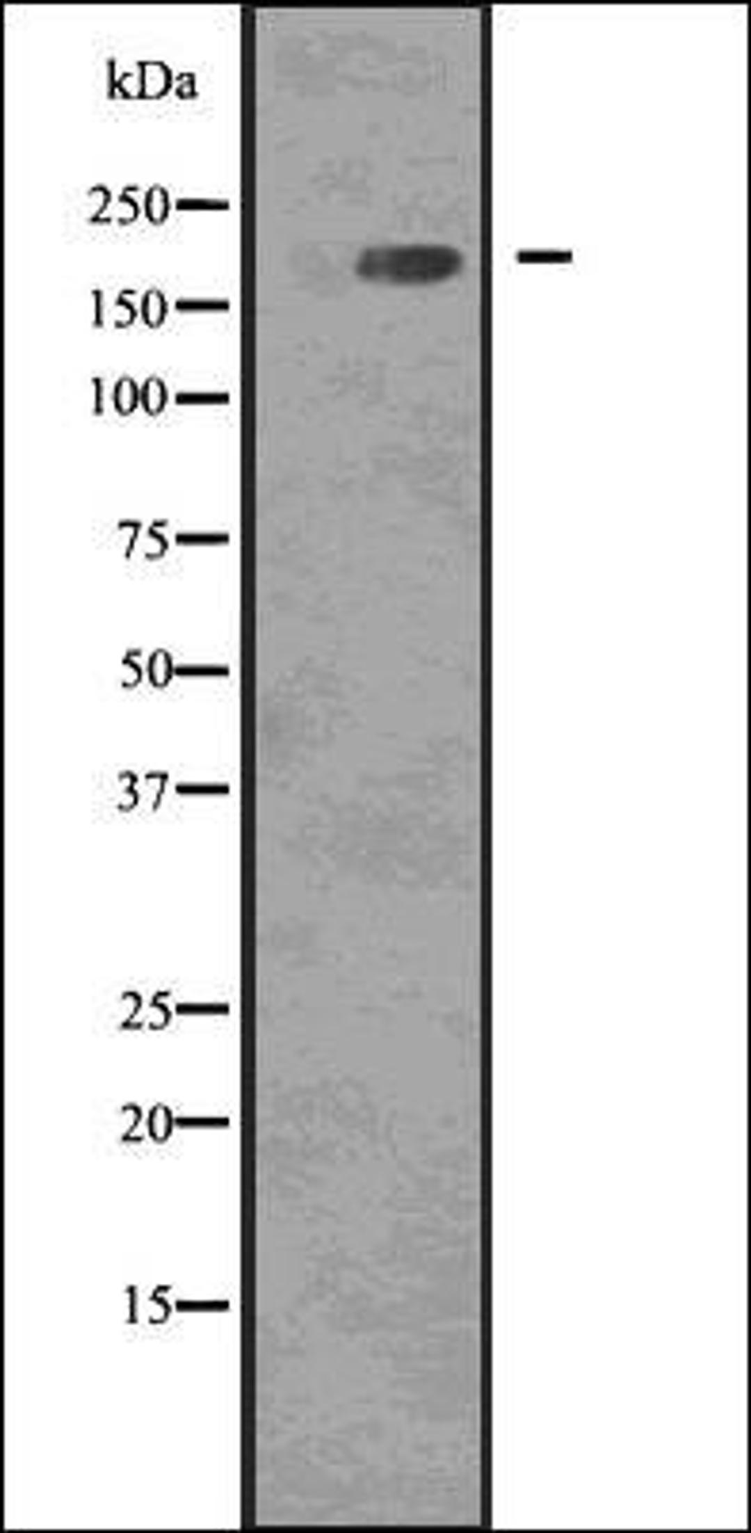 Western blot analysis of COLO205 whole cell lysates using EGFR -Phospho- Tyr1068 - antibody