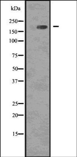 Western blot analysis of COLO205 whole cell lysates using EGFR -Phospho- Tyr1068 - antibody