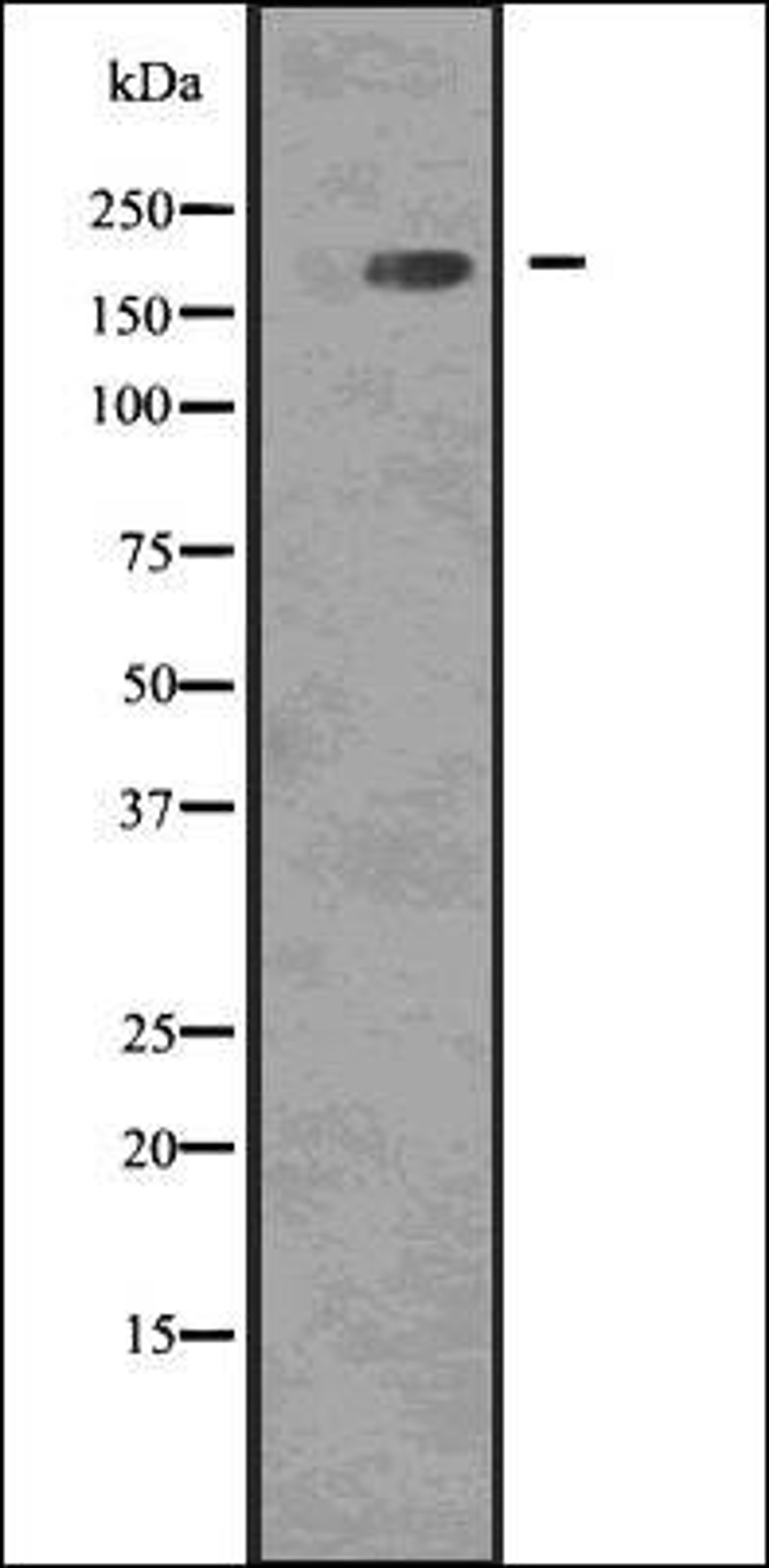 Western blot analysis of COLO205 whole cell lysates using EGFR -Phospho- Tyr1068 - antibody