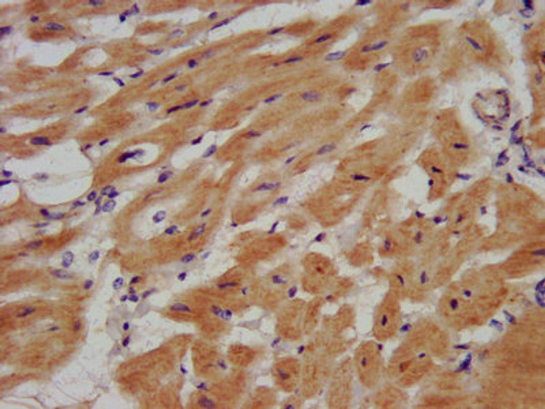 IHC image of CSB-PA857862LA01HU diluted at 1:500 and staining in paraffin-embedded human heart tissue performed on a Leica BondTM system. After dewaxing and hydration, antigen retrieval was mediated by high pressure in a citrate buffer (pH 6.0). Section was blocked with 10% normal goat serum 30min at RT. Then primary antibody (1% BSA) was incubated at 4&deg;C overnight. The primary is detected by a biotinylated secondary antibody and visualized using an HRP conjugated SP system.