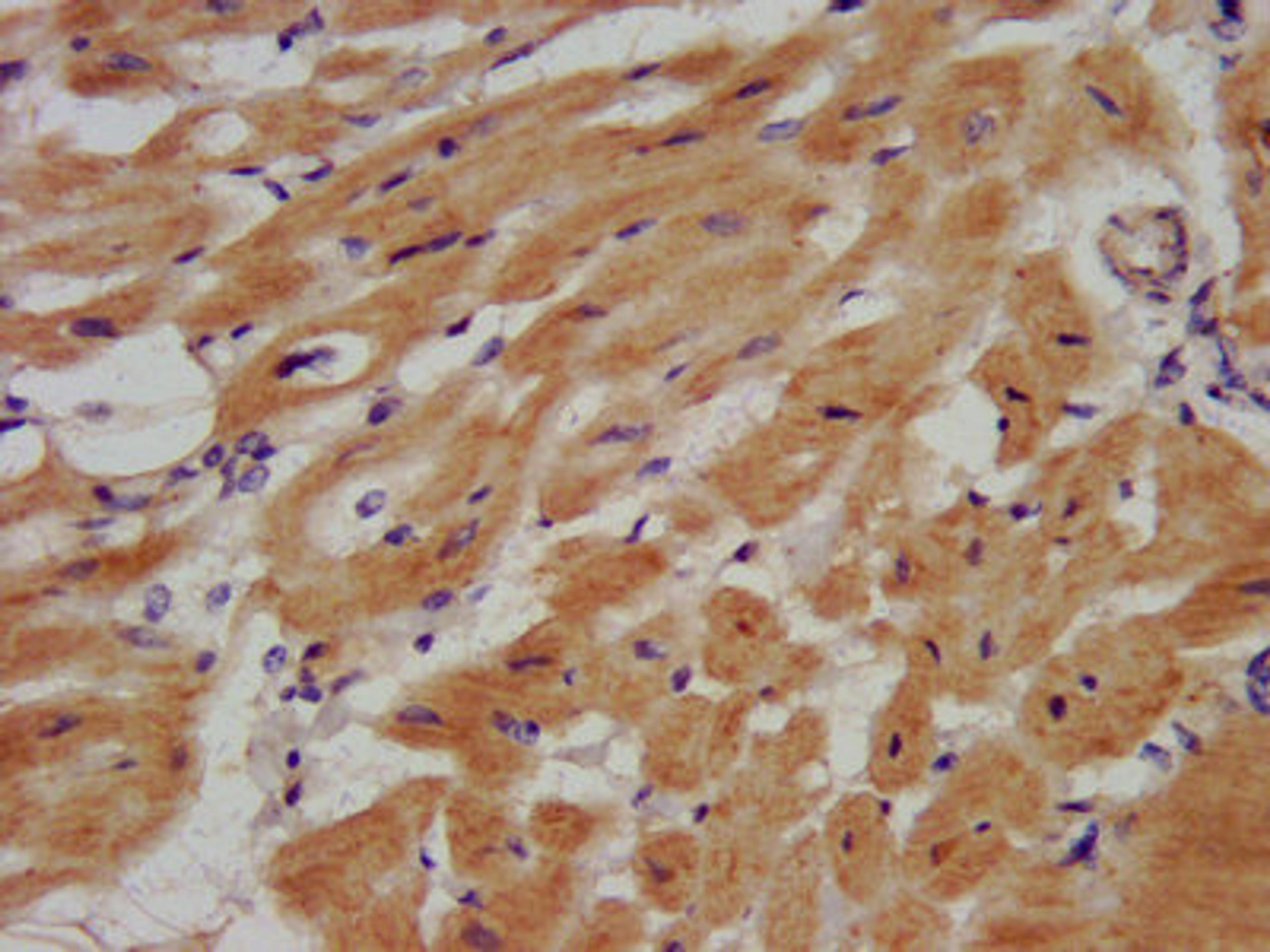 IHC image of CSB-PA857862LA01HU diluted at 1:500 and staining in paraffin-embedded human heart tissue performed on a Leica BondTM system. After dewaxing and hydration, antigen retrieval was mediated by high pressure in a citrate buffer (pH 6.0). Section was blocked with 10% normal goat serum 30min at RT. Then primary antibody (1% BSA) was incubated at 4&deg;C overnight. The primary is detected by a biotinylated secondary antibody and visualized using an HRP conjugated SP system.