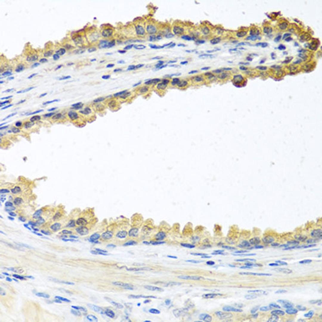 Immunohistochemistry - COCH antibody (A6562)