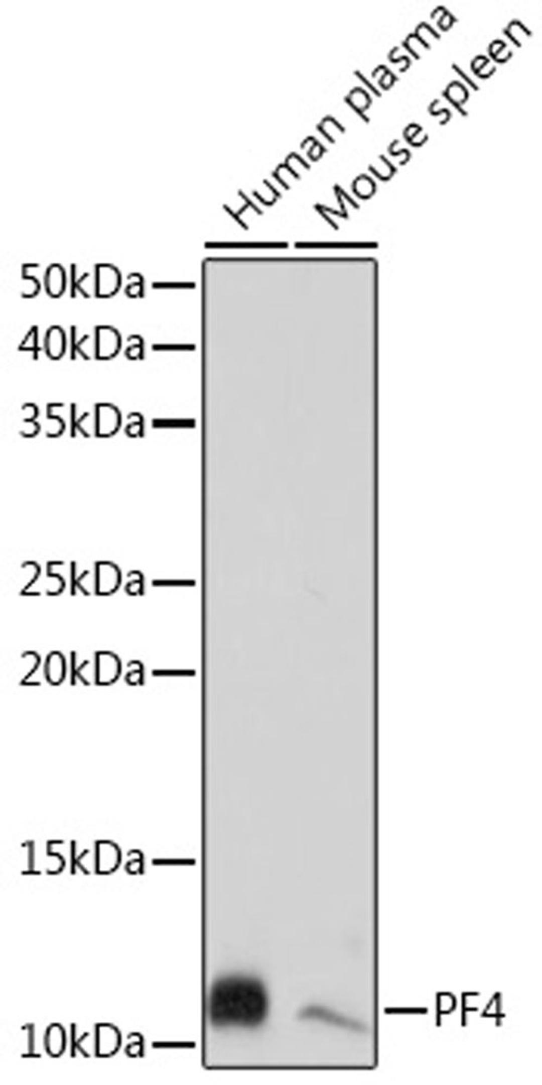 Western blot - PF4 Rabbit mAb (A3694)