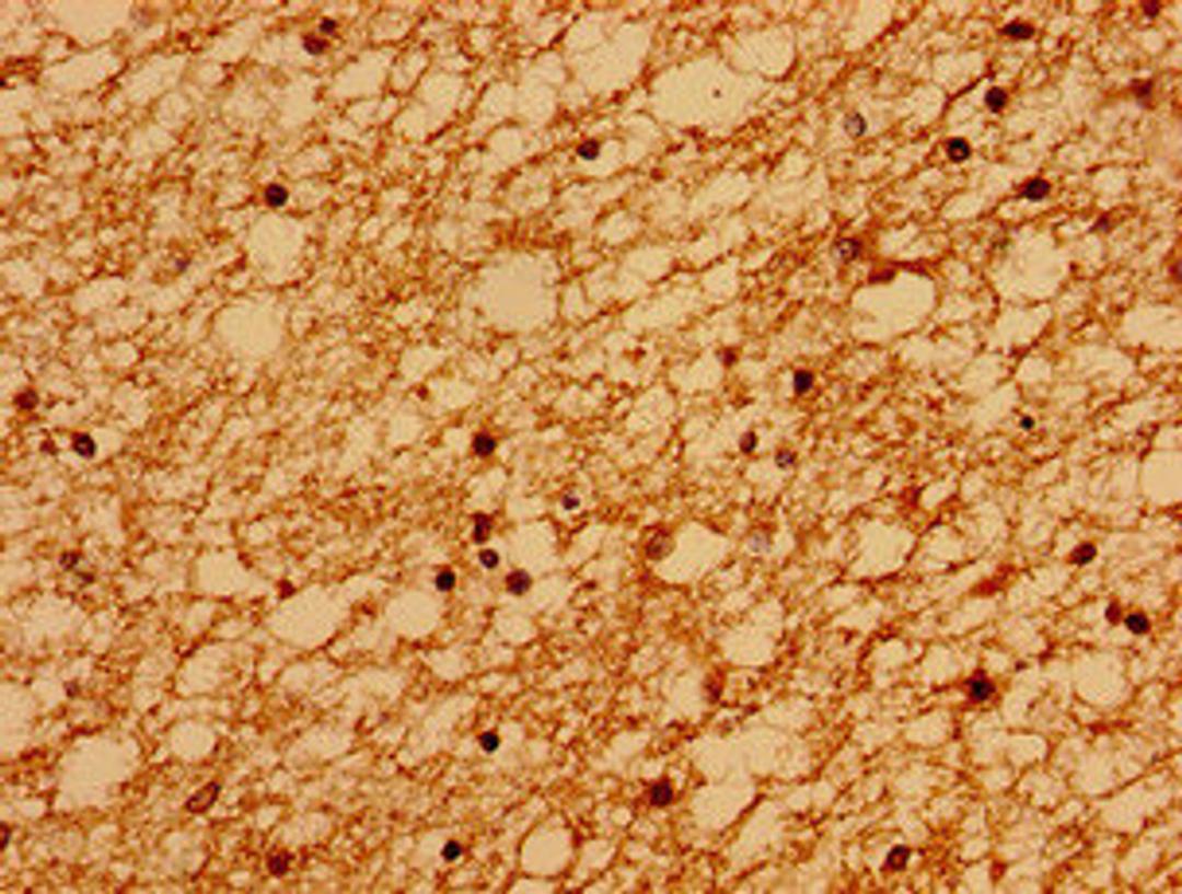 Immunohistochemistry of paraffin-embedded human brain tissue using CSB-PA873707LA01HU at dilution of 1:100