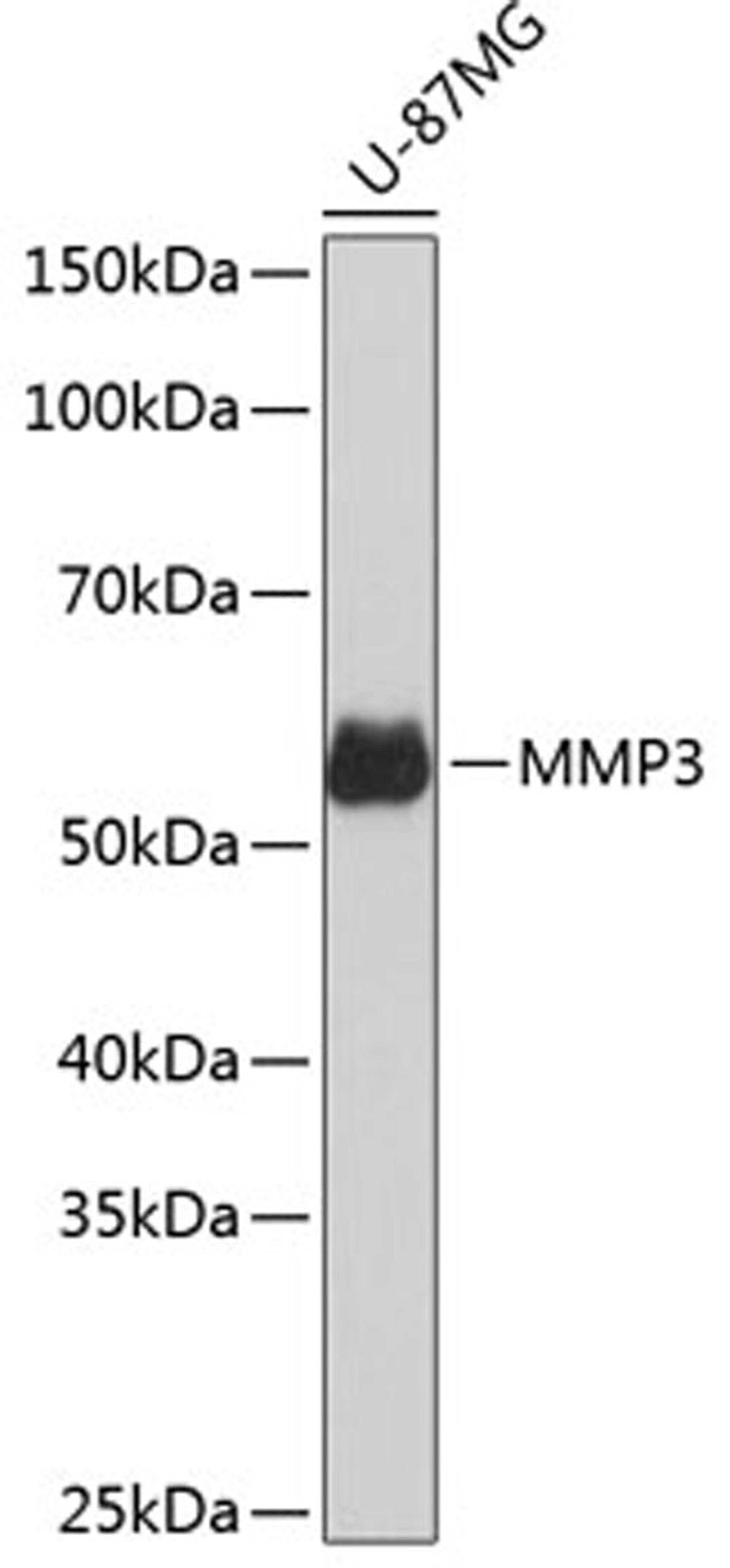 Western blot - MMP3 Rabbit mAb (A11418)