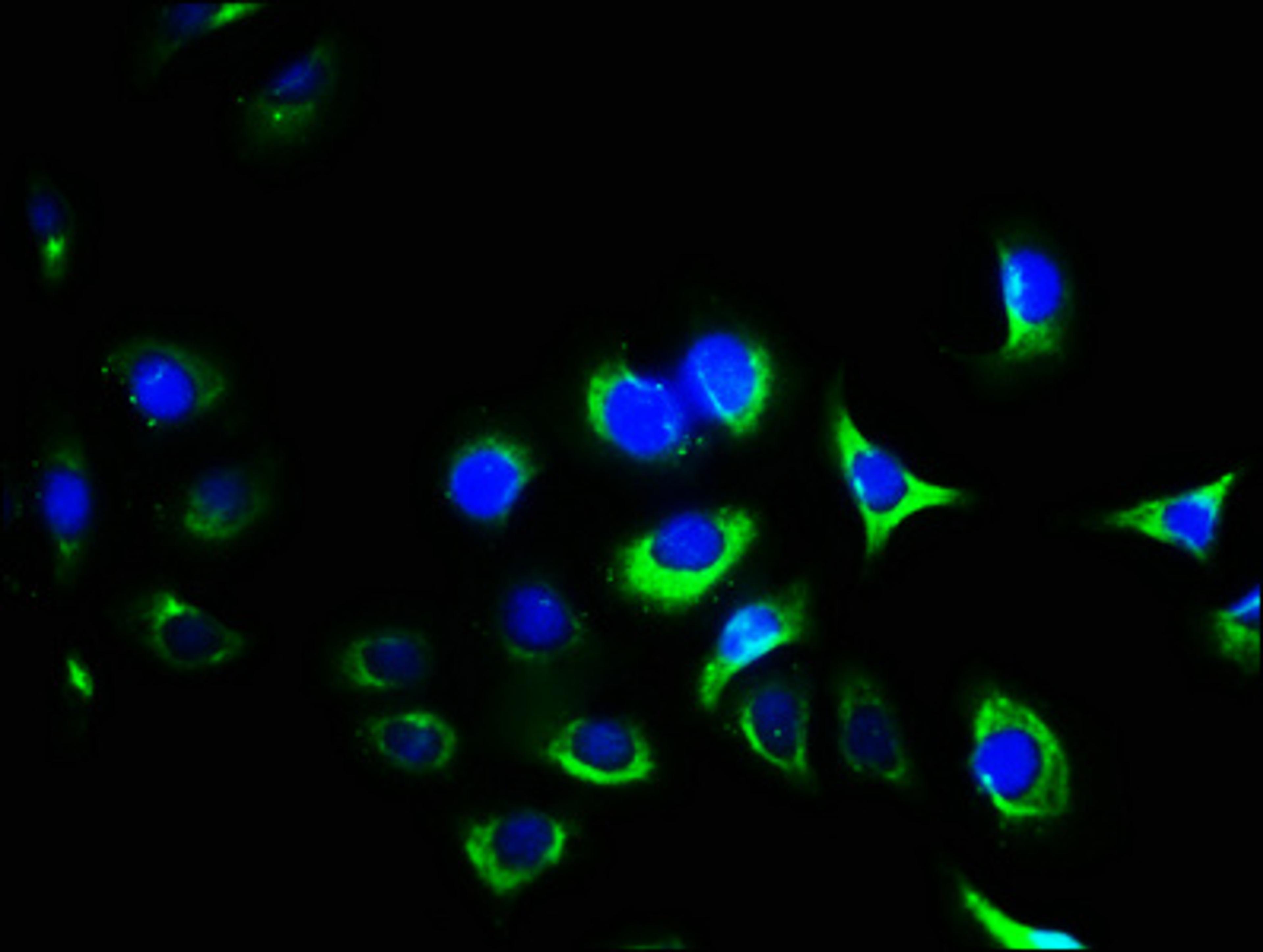 Immunofluorescence staining of A549 cells with CSB-PA011865LA01HU at 1:400, counter-stained with DAPI. The cells were fixed in 4% formaldehyde, permeabilized using 0.2% Triton X-100 and blocked in 10% normal Goat Serum. The cells were then incubated with the antibody overnight at 4&deg;C. The secondary antibody was Alexa Fluor 488-congugated AffiniPure Goat Anti-Rabbit IgG(H+L).