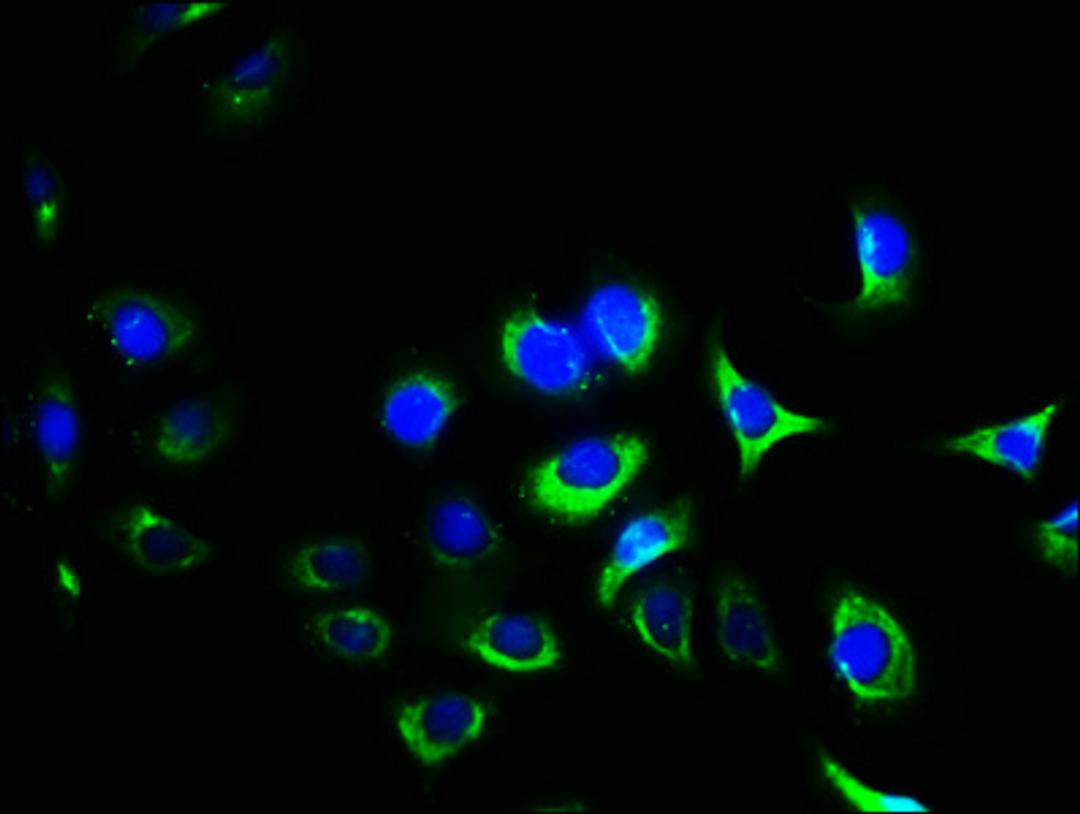Immunofluorescence staining of A549 cells with CSB-PA011865LA01HU at 1:400, counter-stained with DAPI. The cells were fixed in 4% formaldehyde, permeabilized using 0.2% Triton X-100 and blocked in 10% normal Goat Serum. The cells were then incubated with the antibody overnight at 4°C. The secondary antibody was Alexa Fluor 488-congugated AffiniPure Goat Anti-Rabbit IgG(H+L).