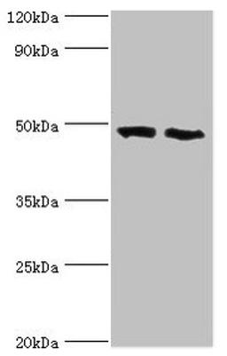 Western blot. All lanes: FDFT1 antibody at 2µg/ml. Lane 1: 293T whole cell lysate. Lane 2: Mouse liver tissue. Secondary. Goat polyclonal to rabbit IgG at 1/10000 dilution. Predicted band size: 49, 41, 39, 36, 44 kDa. Observed band size: 49 kDa