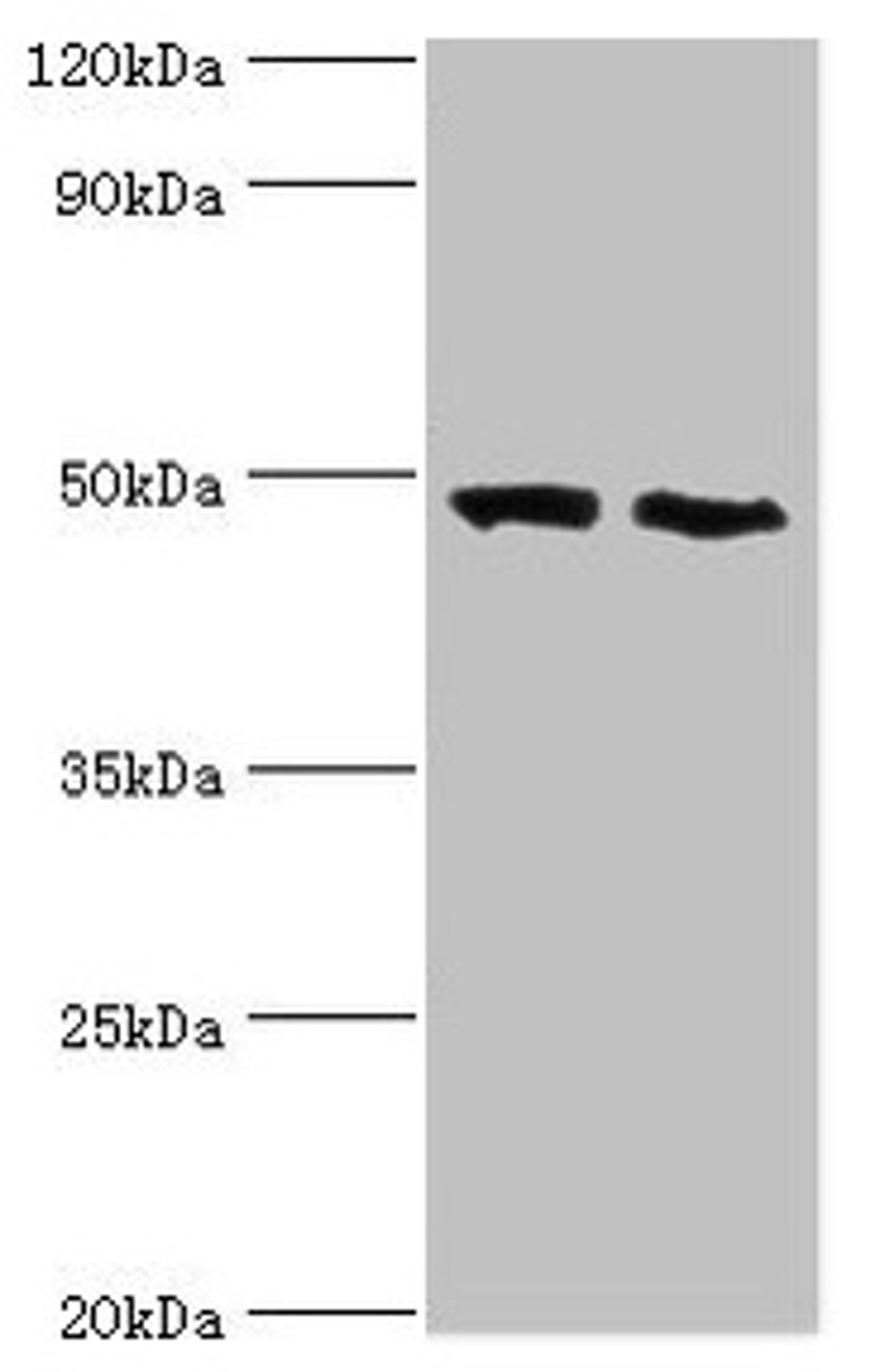 Western blot. All lanes: FDFT1 antibody at 2µg/ml. Lane 1: 293T whole cell lysate. Lane 2: Mouse liver tissue. Secondary. Goat polyclonal to rabbit IgG at 1/10000 dilution. Predicted band size: 49, 41, 39, 36, 44 kDa. Observed band size: 49 kDa