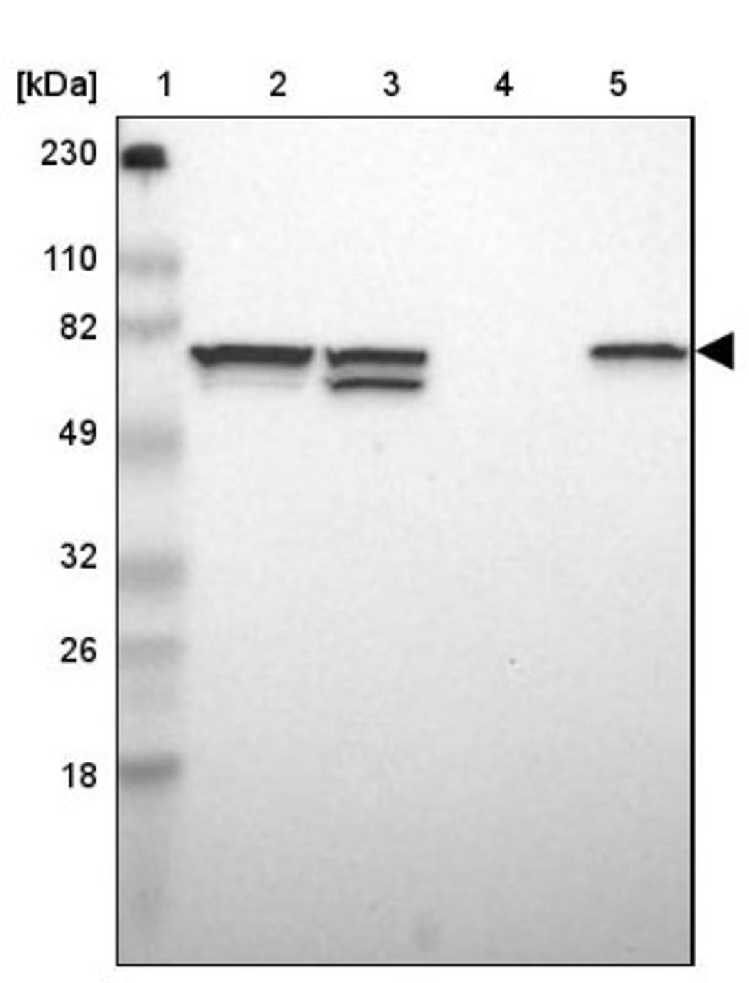 Western Blot: SETD3 Antibody [NBP1-88416] - Lane 1: Marker [kDa] 230, 110, 82, 49, 32, 26, 18<br/>Lane 2: Human cell line RT-4<br/>Lane 3: Human cell line U-251MG sp<br/>Lane 4: Human plasma (IgG/HSA depleted)<br/>Lane 5: Human liver tissue