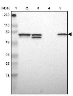 Western Blot: SETD3 Antibody [NBP1-88416] - Lane 1: Marker [kDa] 230, 110, 82, 49, 32, 26, 18<br/>Lane 2: Human cell line RT-4<br/>Lane 3: Human cell line U-251MG sp<br/>Lane 4: Human plasma (IgG/HSA depleted)<br/>Lane 5: Human liver tissue