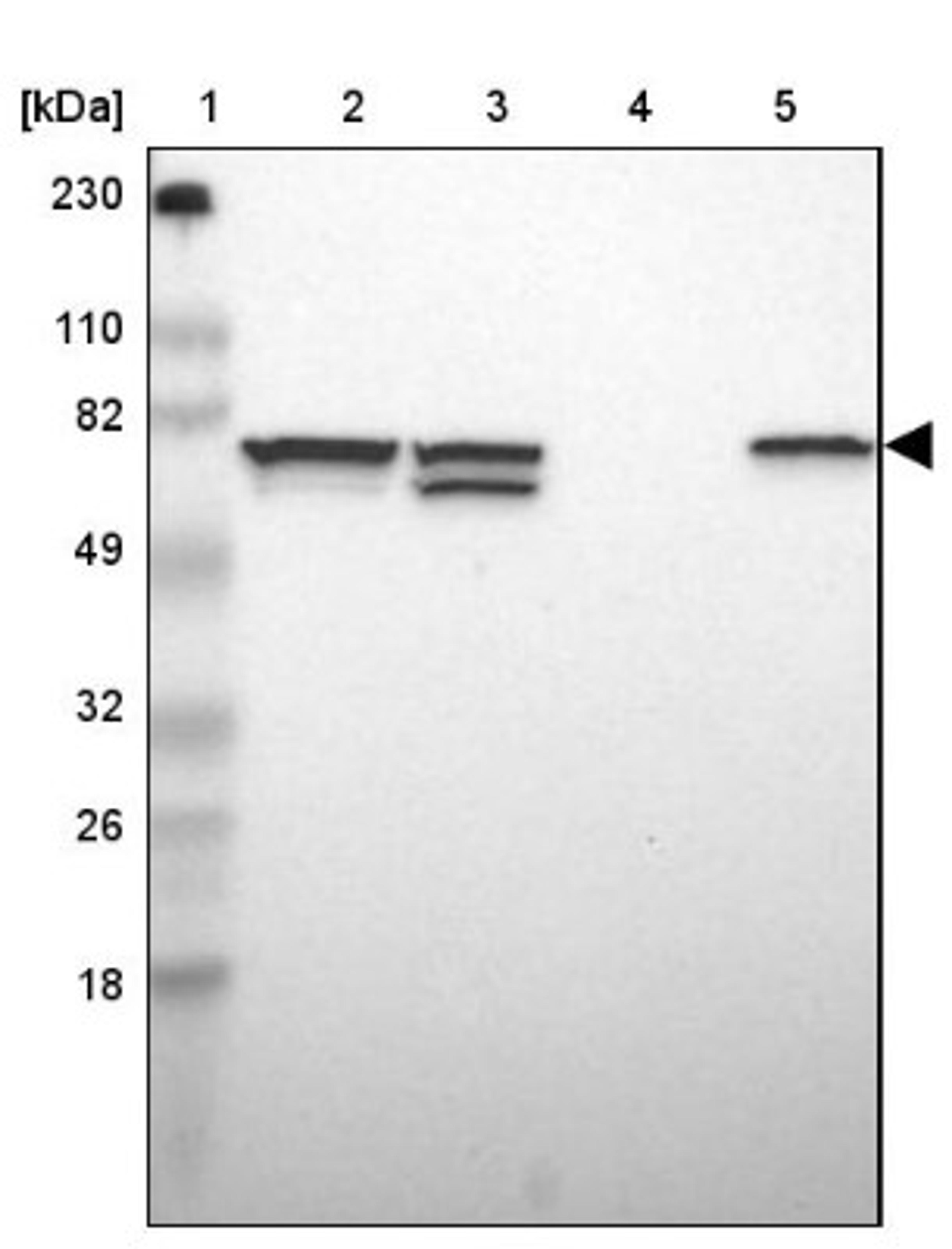 Western Blot: SETD3 Antibody [NBP1-88416] - Lane 1: Marker [kDa] 230, 110, 82, 49, 32, 26, 18<br/>Lane 2: Human cell line RT-4<br/>Lane 3: Human cell line U-251MG sp<br/>Lane 4: Human plasma (IgG/HSA depleted)<br/>Lane 5: Human liver tissue