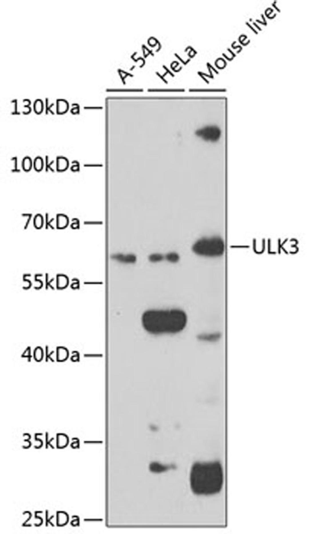 Western blot - ULK3 antibody (A7587)