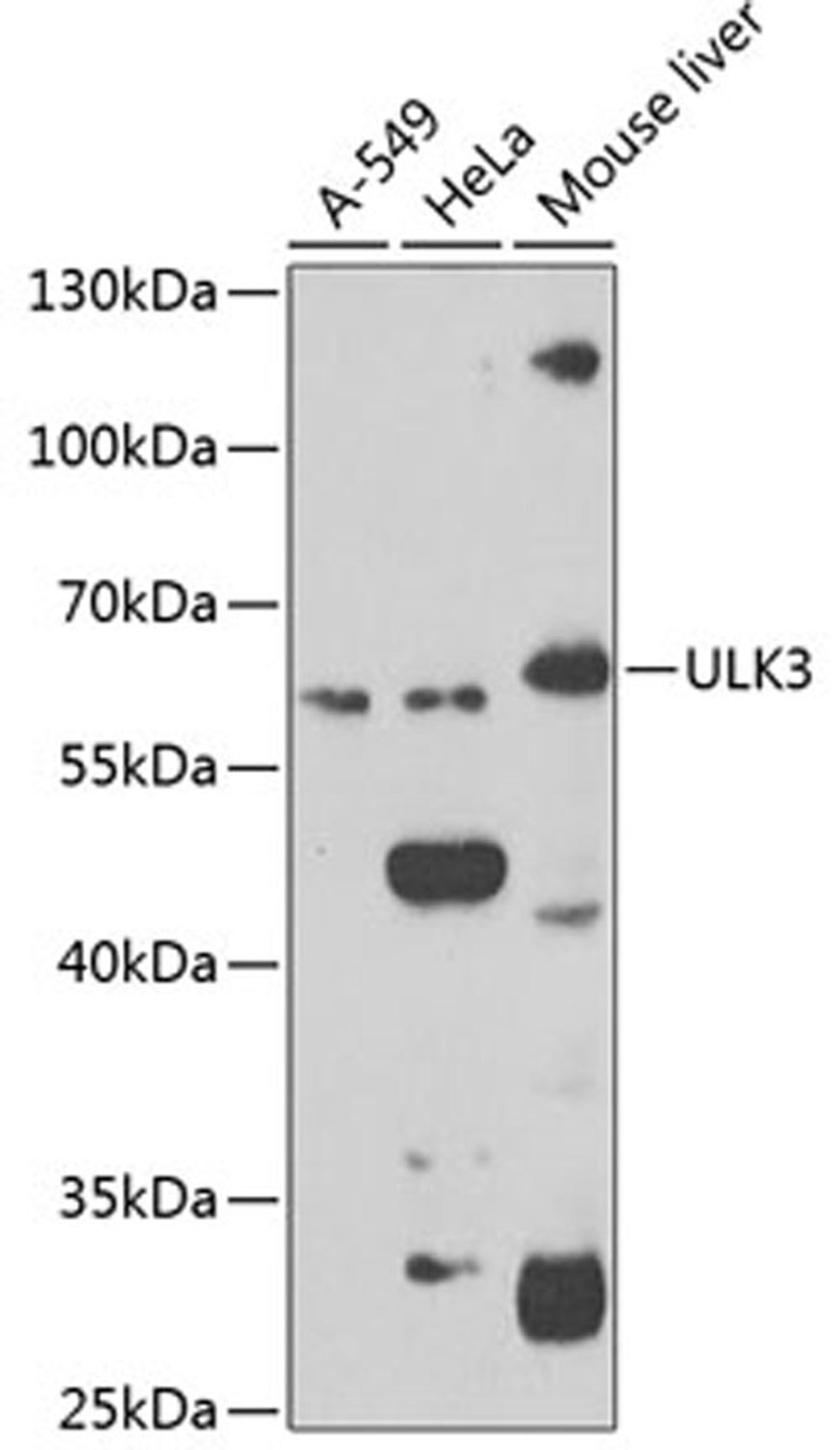 Western blot - ULK3 antibody (A7587)