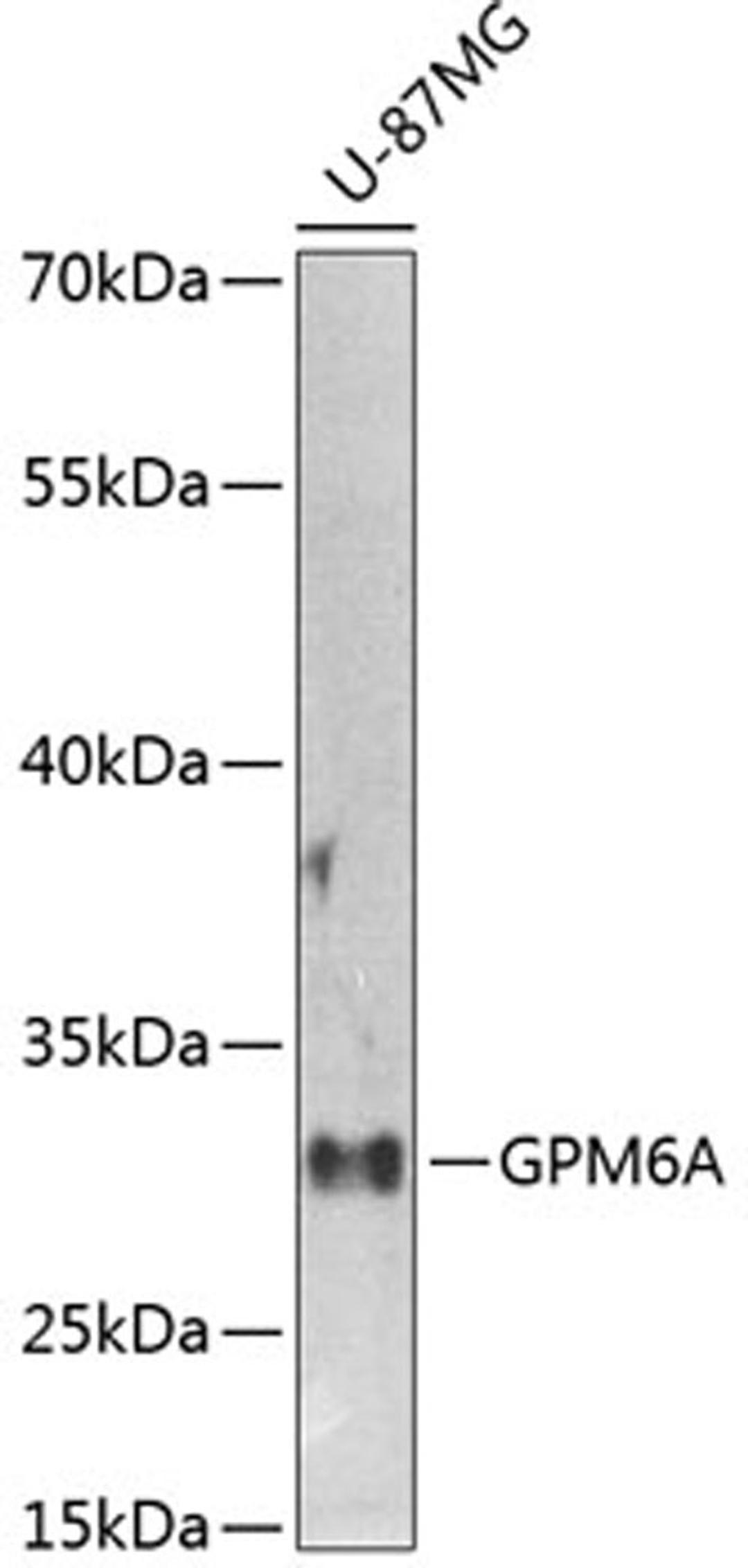 Western blot - GPM6A antibody (A9066)