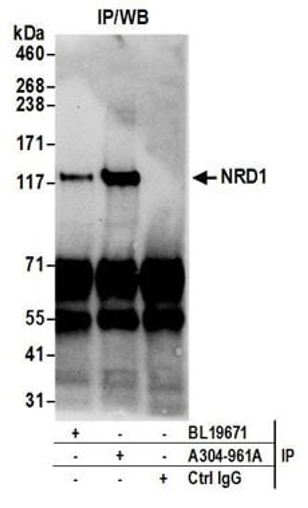 Detection of human NRD1 by western blot of immunoprecipitates.