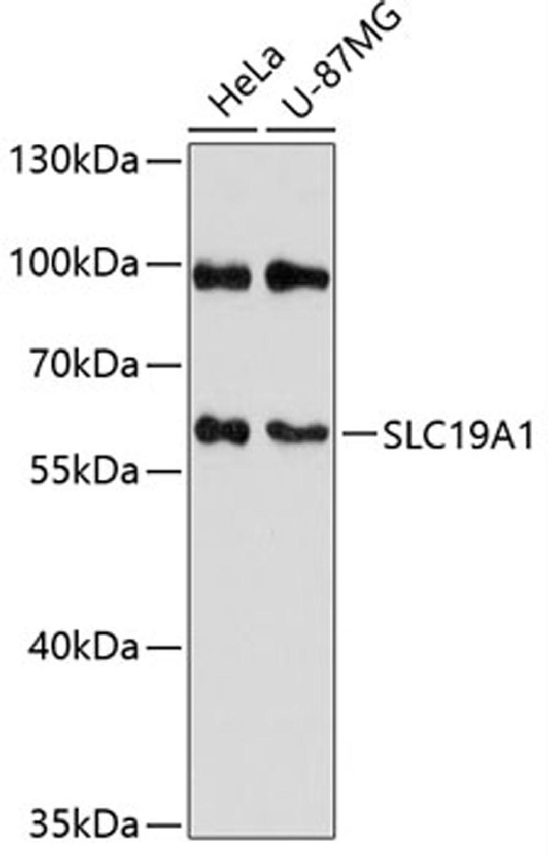 Western blot - SLC19A1 antibody (A12819)