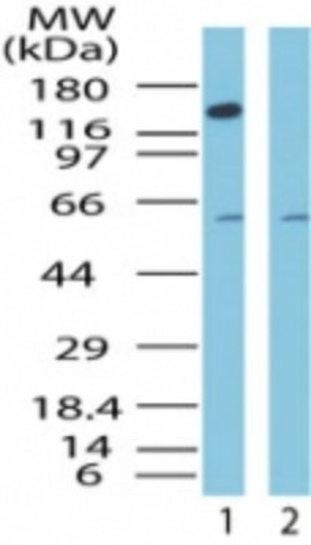 Western Blot: CTCF Antibody [NB100-56494] - analysis of CTCF in nuclear fraction HeLa cell lysate in the 1) absence and 2) presence of immunizing peptide using this antibody.