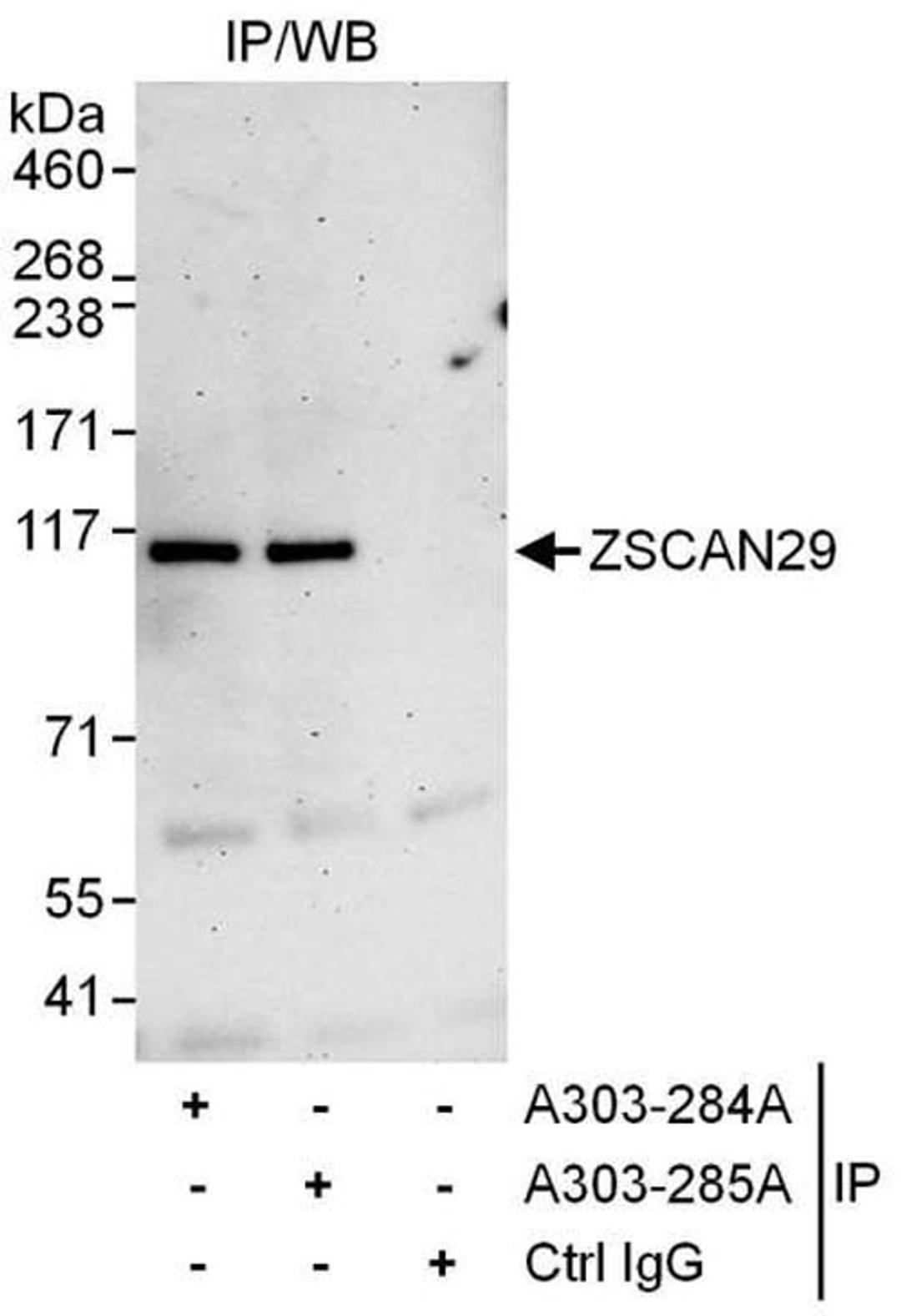 Detection of human ZSCAN29 by WB of IP.