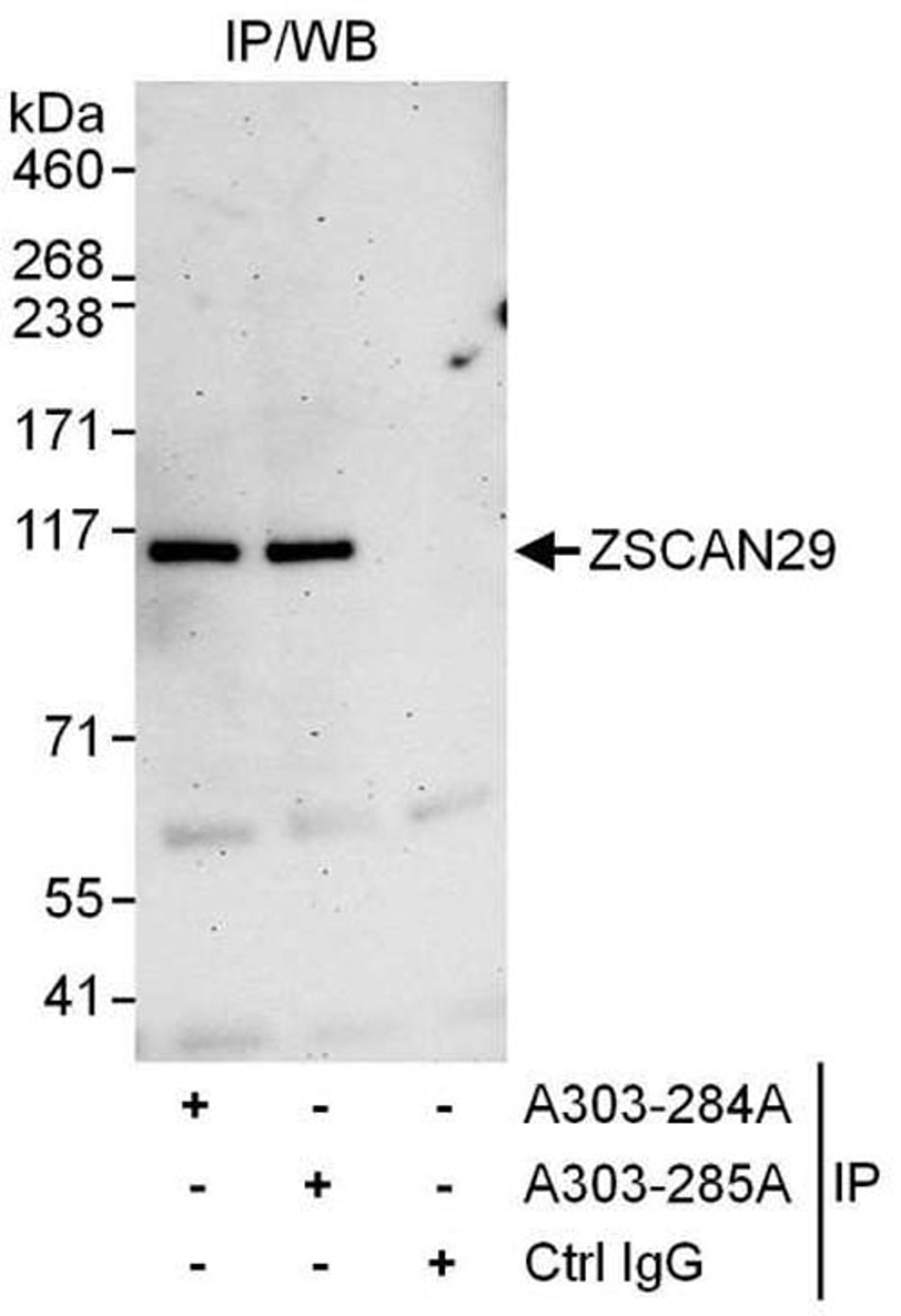 Detection of human ZSCAN29 by WB of IP.