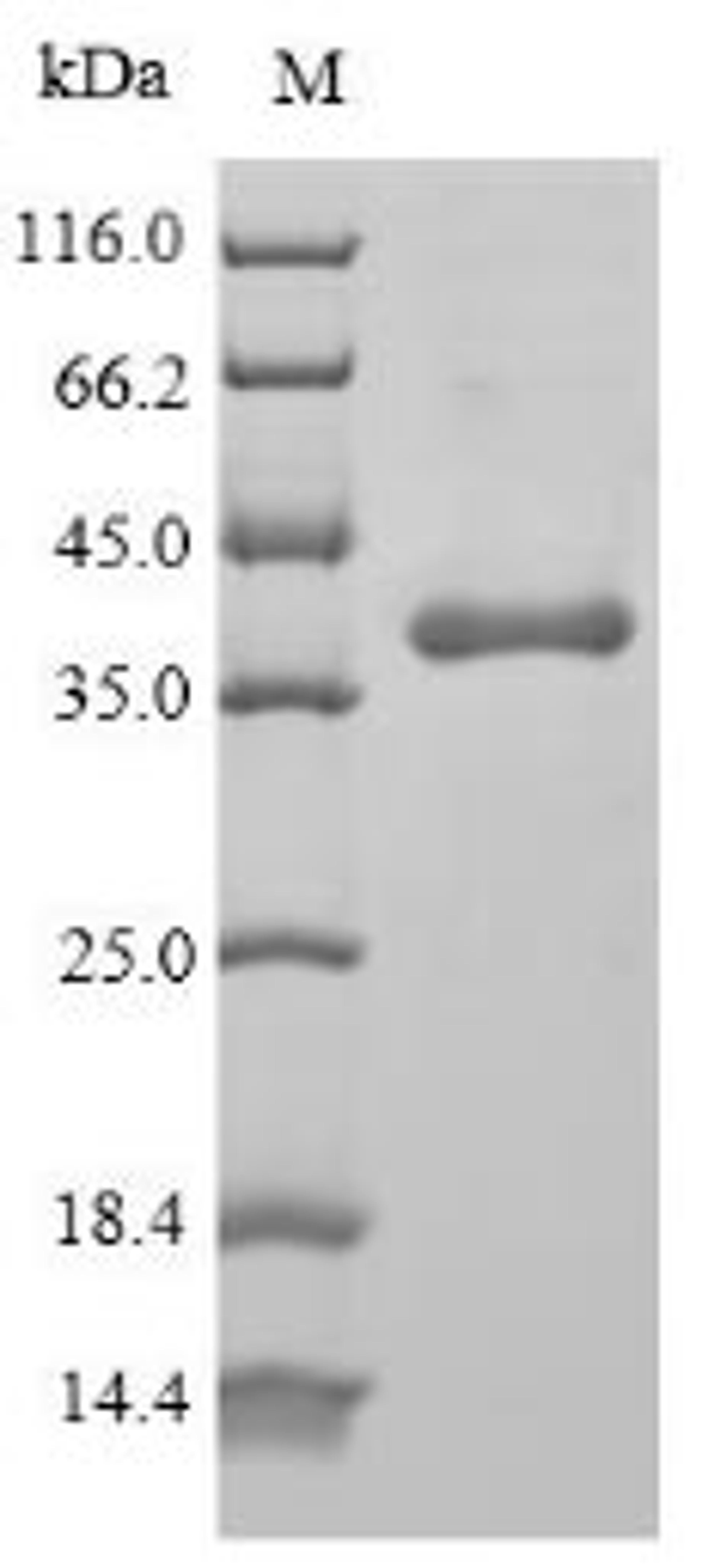 (Tris-Glycine gel) Discontinuous SDS-PAGE (reduced) with 5% enrichment gel and 15% separation gel.