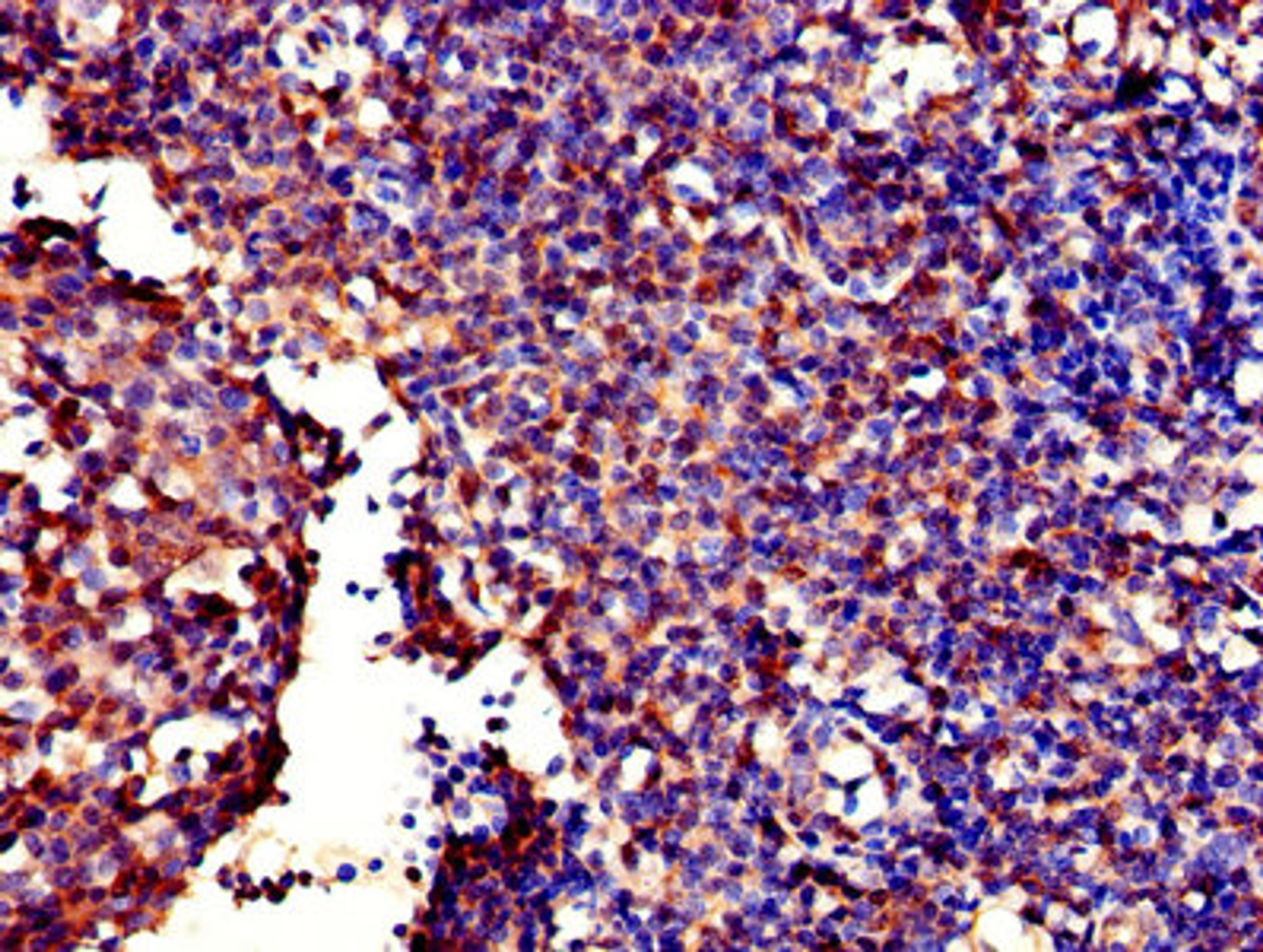 Immunohistochemistry of paraffin-embedded human tonsil tissue using CSB-PA009226LA01HU at dilution of 1:100