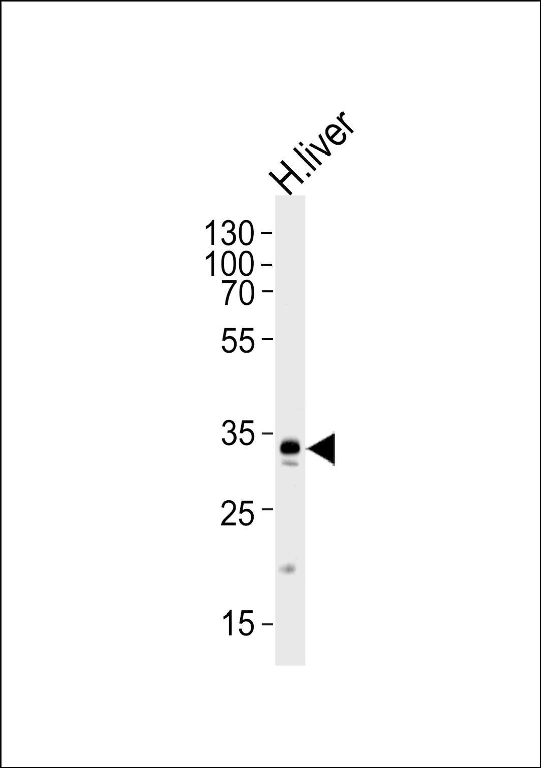 Western blot analysis of lysate from human liver tissue lysate, using GPD1 Antibody at 1:1000 at each lane.