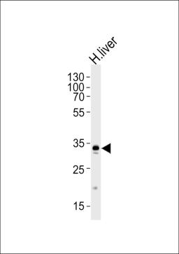 Western blot analysis of lysate from human liver tissue lysate, using GPD1 Antibody at 1:1000 at each lane.