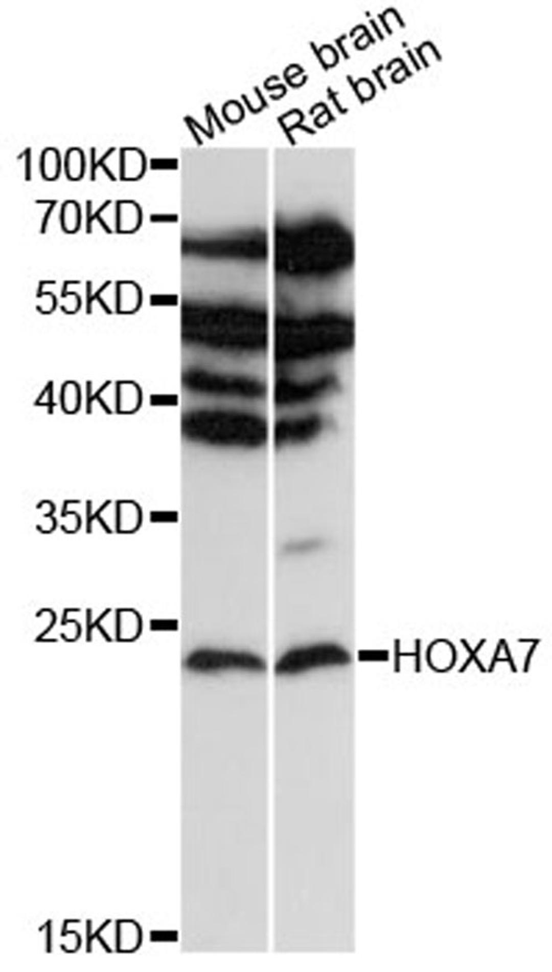 Western blot - HOXA7 antibody (A12891)