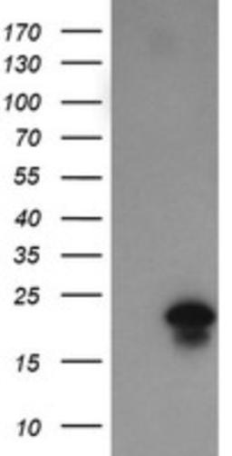 Western Blot: FATE1 Antibody (1A1) [NBP2-45594] - Analysis of HEK293T cells were transfected with the pCMV6-ENTRY control (Left lane) or pCMV6-ENTRY FATE1.