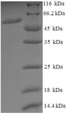 (Tris-Glycine gel) Discontinuous SDS-PAGE (reduced) with 5% enrichment gel and 15% separation gel.