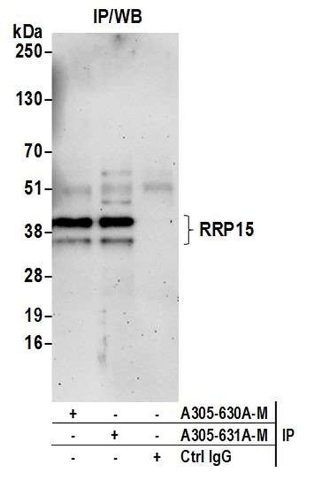 Detection of human RRP15 by WB of IP.