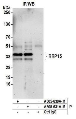 Detection of human RRP15 by WB of IP.