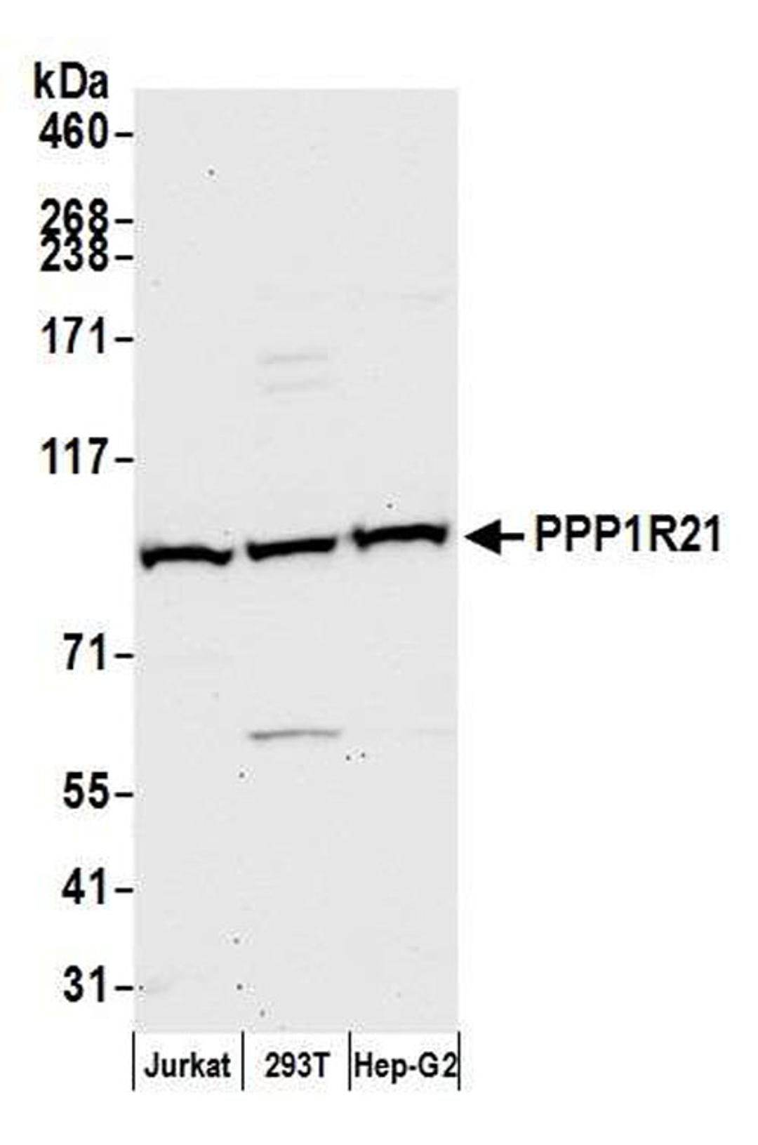 Detection of human PPP1R21 by WB.