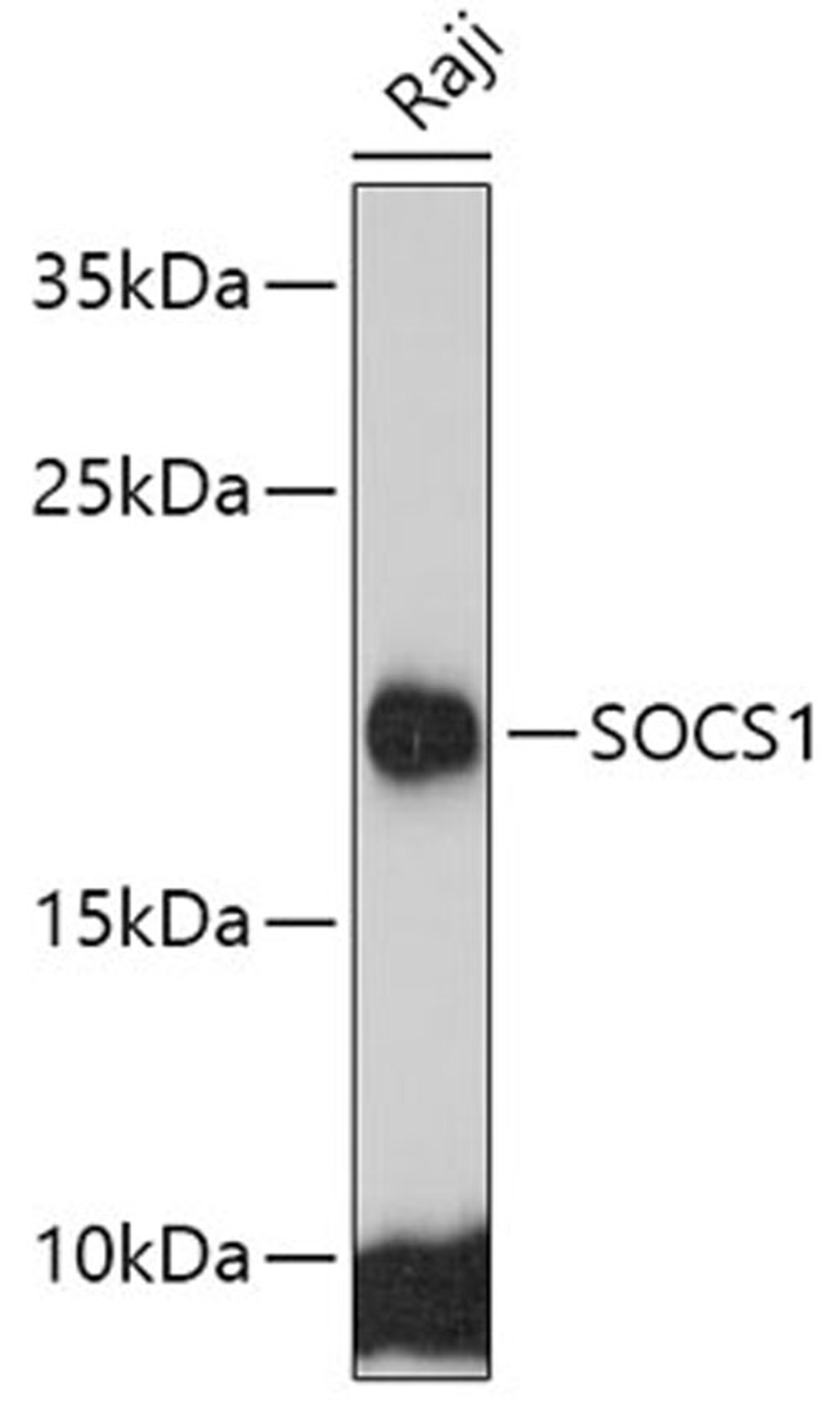 Western blot - SOCS1 antibody (A7754)