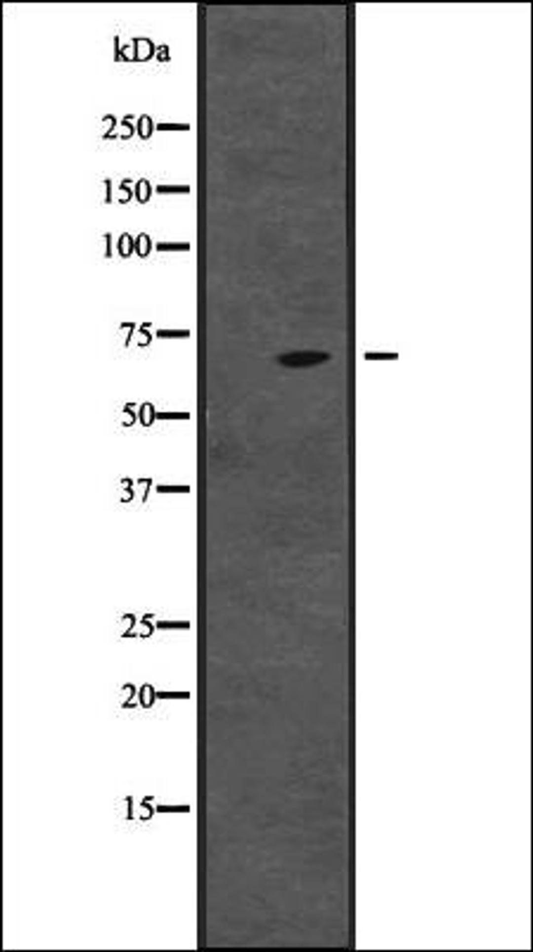 Western blot analysis of HepG2 cell lysate using CENPT antibody