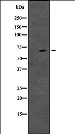 Western blot analysis of HepG2 cell lysate using CENPT antibody