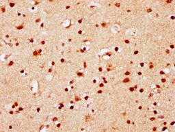 IHC image of CSB-PA010389PA95nsucHU diluted at 1:10 and staining in paraffin-embedded human brain tissue performed on a Leica BondTM system. After dewaxing and hydration, antigen retrieval was mediated by high pressure in a citrate buffer (pH 6.0). Section was blocked with 10% normal goat serum 30min at RT. Then primary antibody (1% BSA) was incubated at 4°C overnight. The primary is detected by a biotinylated secondary antibody and visualized using an HRP conjugated SP system.