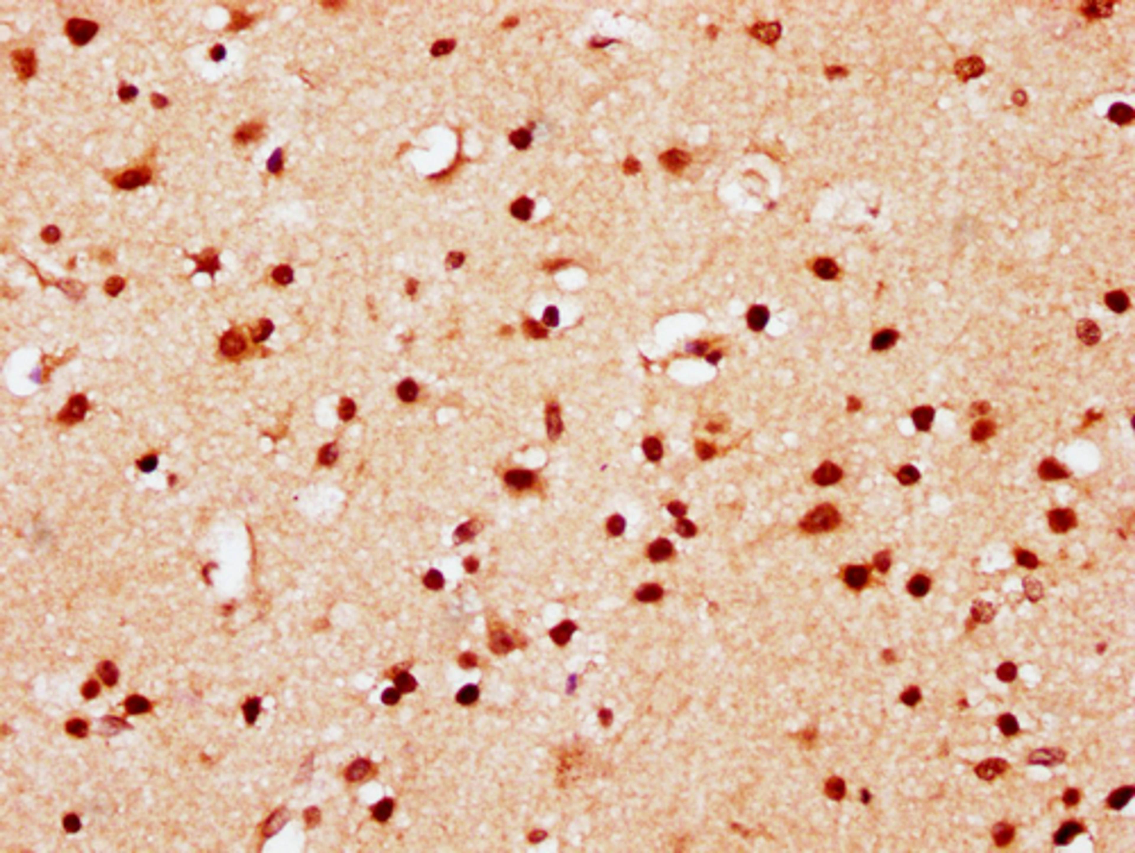 IHC image of CSB-PA010389PA95nsucHU diluted at 1:10 and staining in paraffin-embedded human brain tissue performed on a Leica BondTM system. After dewaxing and hydration, antigen retrieval was mediated by high pressure in a citrate buffer (pH 6.0). Section was blocked with 10% normal goat serum 30min at RT. Then primary antibody (1% BSA) was incubated at 4°C overnight. The primary is detected by a biotinylated secondary antibody and visualized using an HRP conjugated SP system.