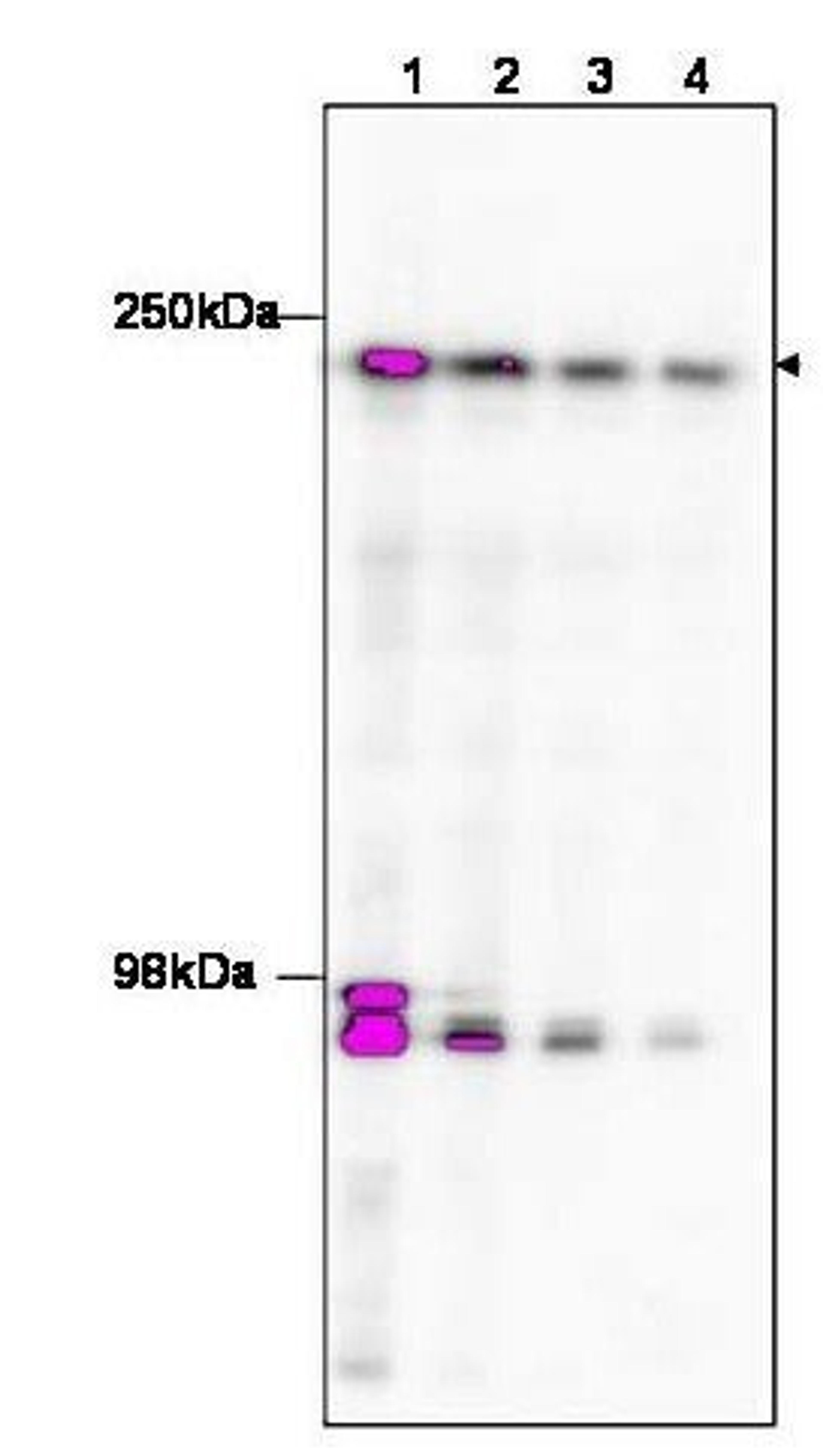 Western blot analysis of HeLa nuclear extract (arrowhead) using TAF1 antibody