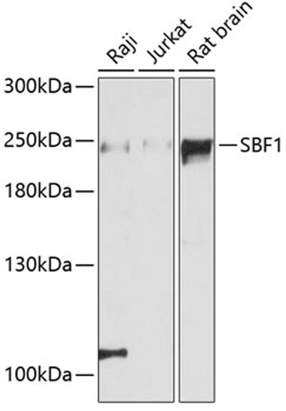 Western blot - SBF1 antibody (A12354)